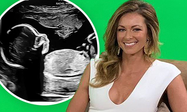 Featured image for Chelsea Meissner of Southern Charm announces pregnancy with undisclosed partner.
