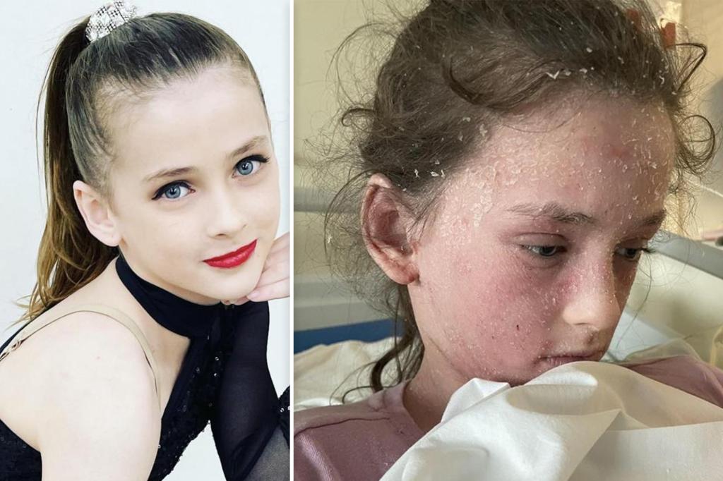Featured image for Girl, 11, Allergic to Own Tears and Sweat Suffers Painful Skin Condition