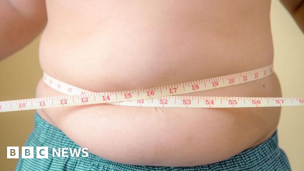 Featured image for Childhood obesity now exceeds underweight rates worldwide, UNICEF reports