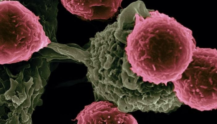 Protein's Role in Metastasis Unveiled by Cancer Research