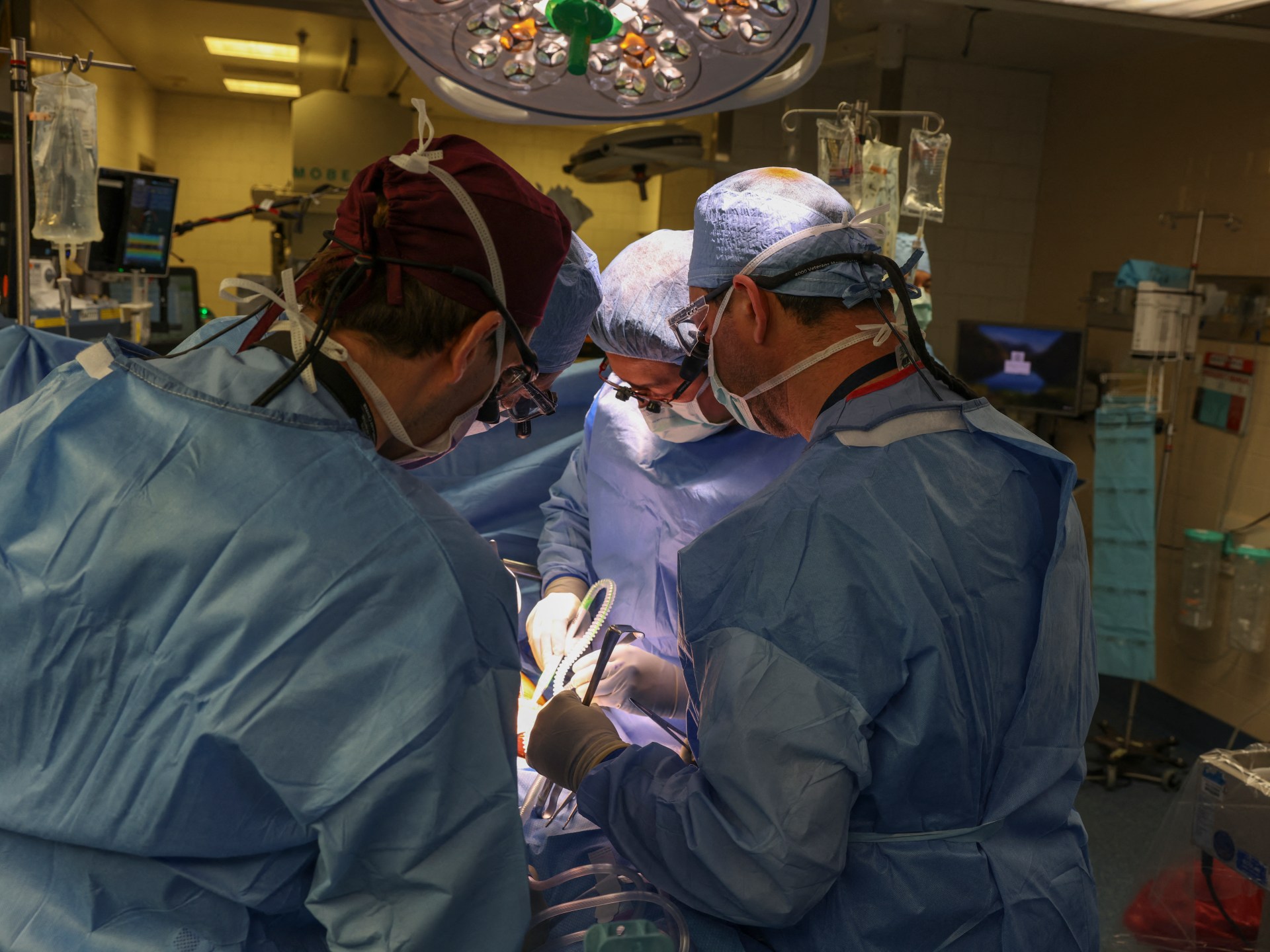 Featured image for "Humanized Porcine Kidney Transplant: A Glimpse into the Future of Transplants"