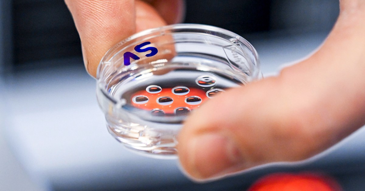 Featured image for "Alabama Embryo Ruling Sparks GOP Struggle and IVF Patient Dilemma"