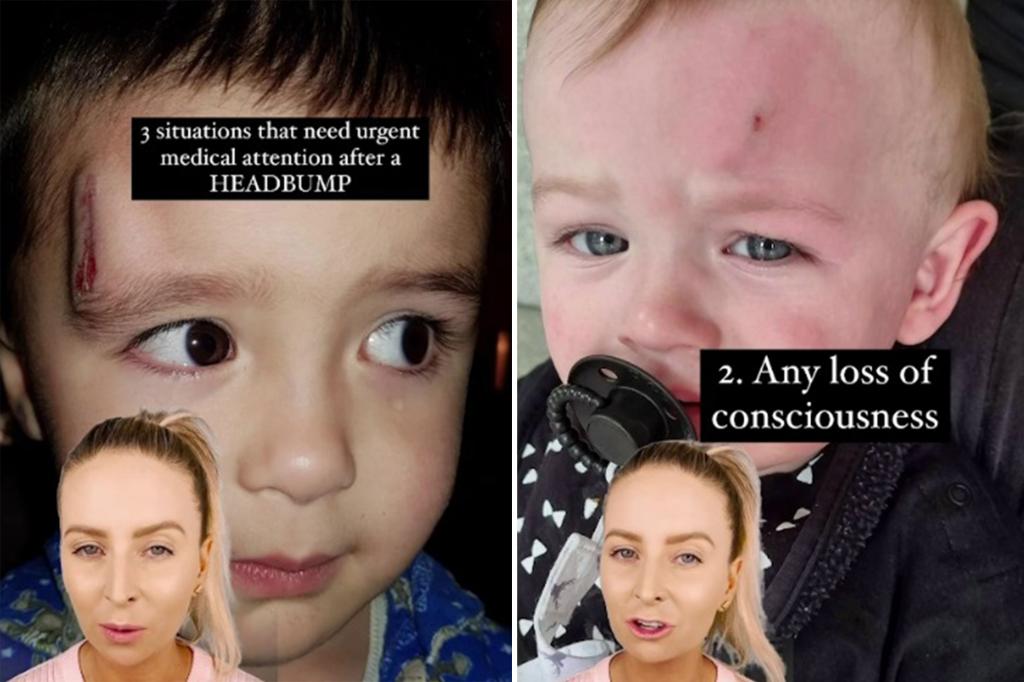 Featured image for Expert Tips for Identifying Emergency Head Bumps in Kids