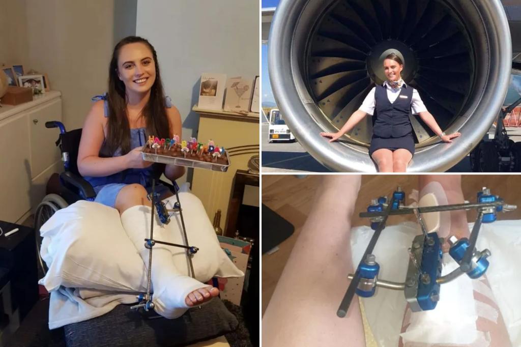 Featured image for Flight Attendant's Career Ends After Severe Turbulence Breaks Leg in Seven Places