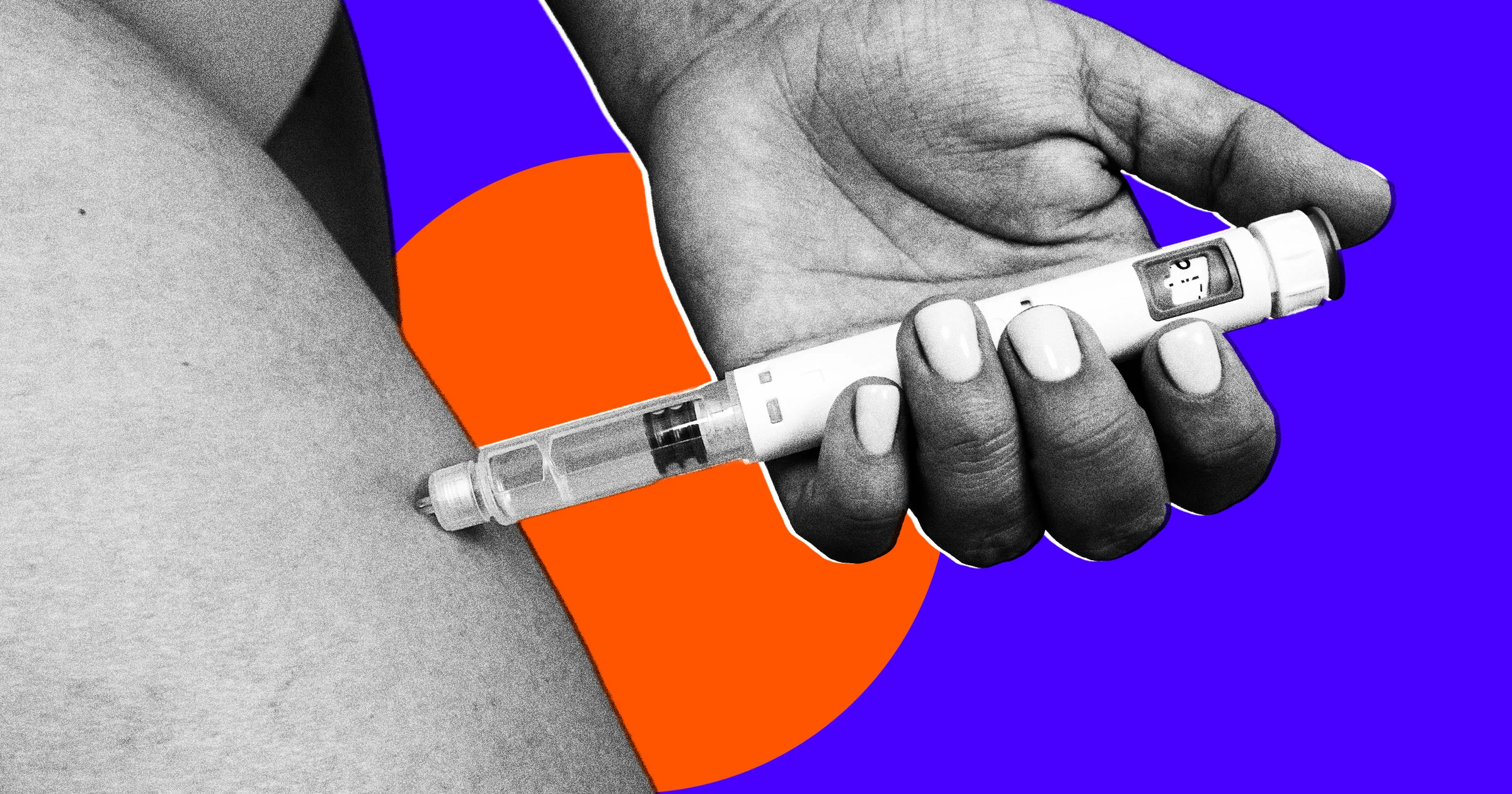 Breakthrough in Diabetes Treatment: Potential Cure from Stem Cell Therapy and New Drugs