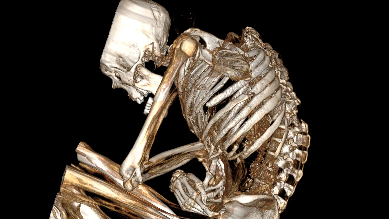 Featured image for 100-Year-Old Mummy in Chile Died from Mine Collapse Injuries