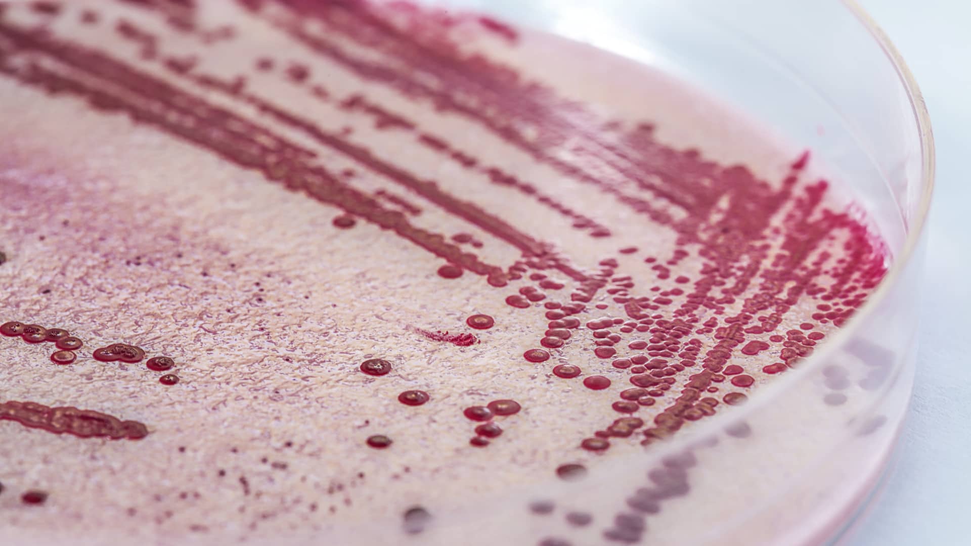 Deadly Listeria Outbreak Linked to Ready-to-Eat Meat Recall