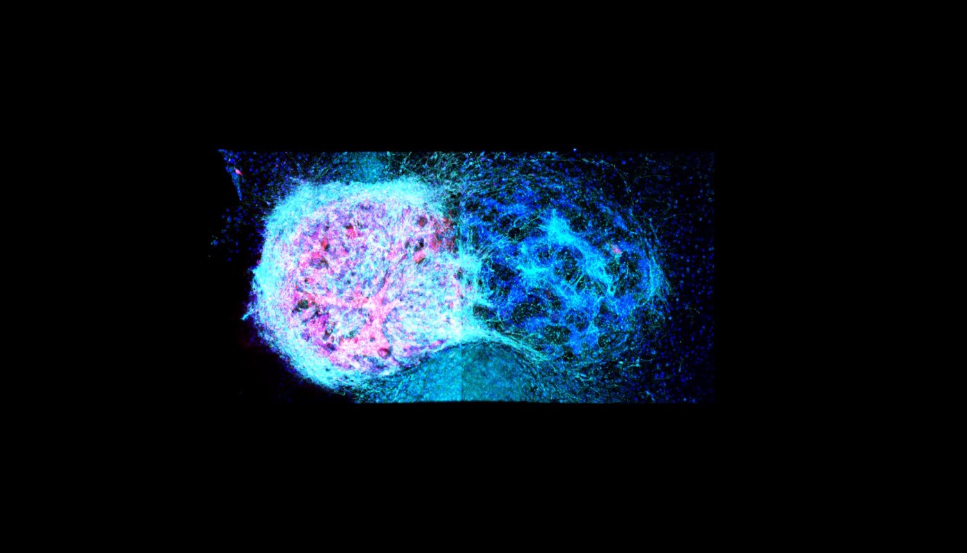 Revolutionary 3D Printing Technique Repairs Brain Injuries with Stem Cells