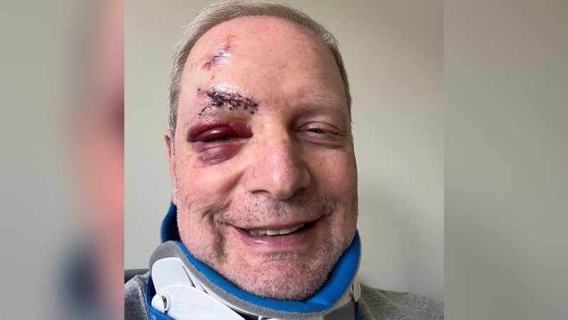 "COVID Expert Falls Ill: Lessons Learned from UCSF Doctor's Personal Experience"