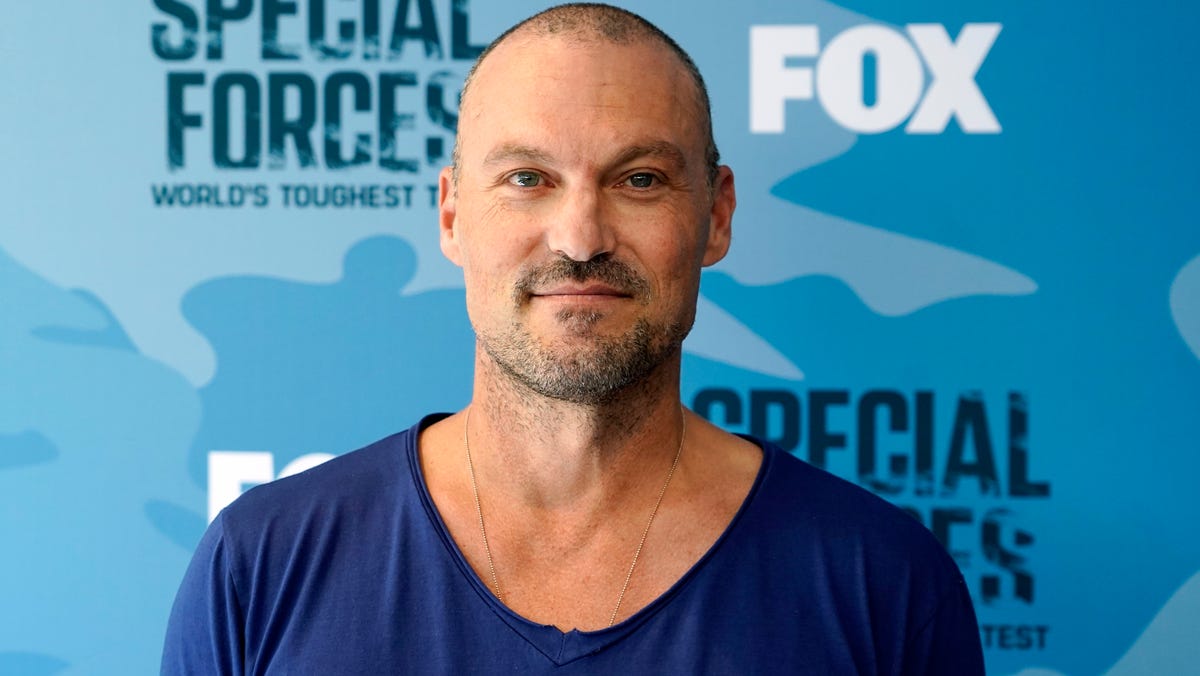 Brian Austin Green's Yearslong Battle with Stroke-Like Symptoms Caused by Diet