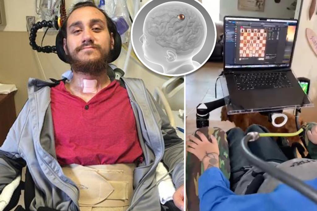 Featured image for "Neuralink's First Human Demonstrates Mind-Controlled Cursor Movement"