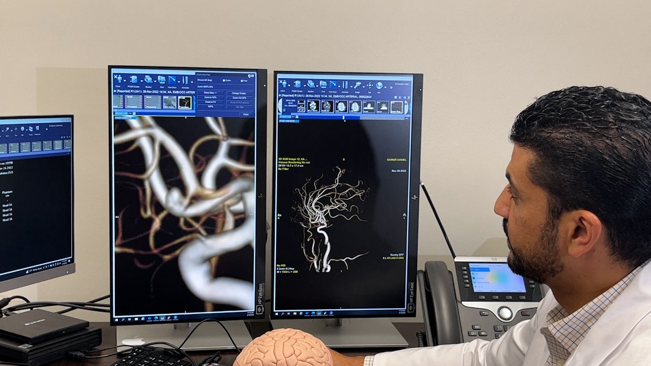 Featured image for Stroke Risk Increasing in Young Adults: What You Need to Know.