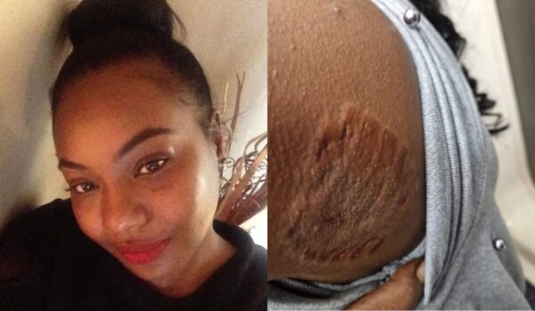 Featured image for Racist Subway Attack: Woman Bitten and Hair Pulled Out as Police Officer Watches