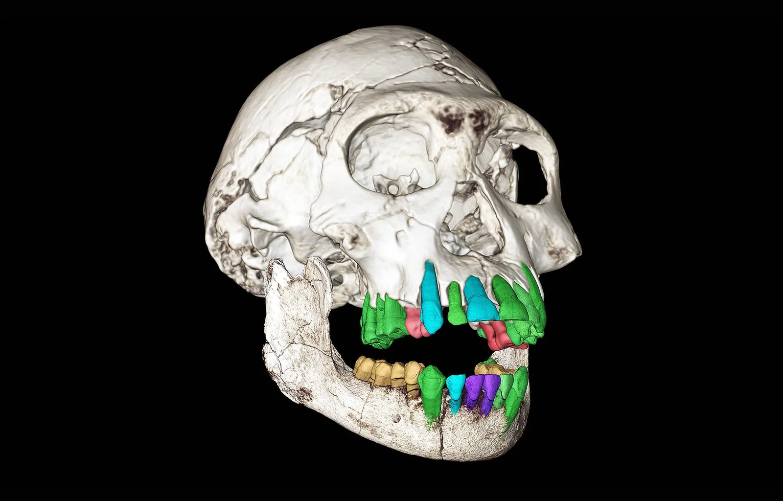 Featured image for Fossil Teeth Uncover Reasons for Extended Human Childhood
