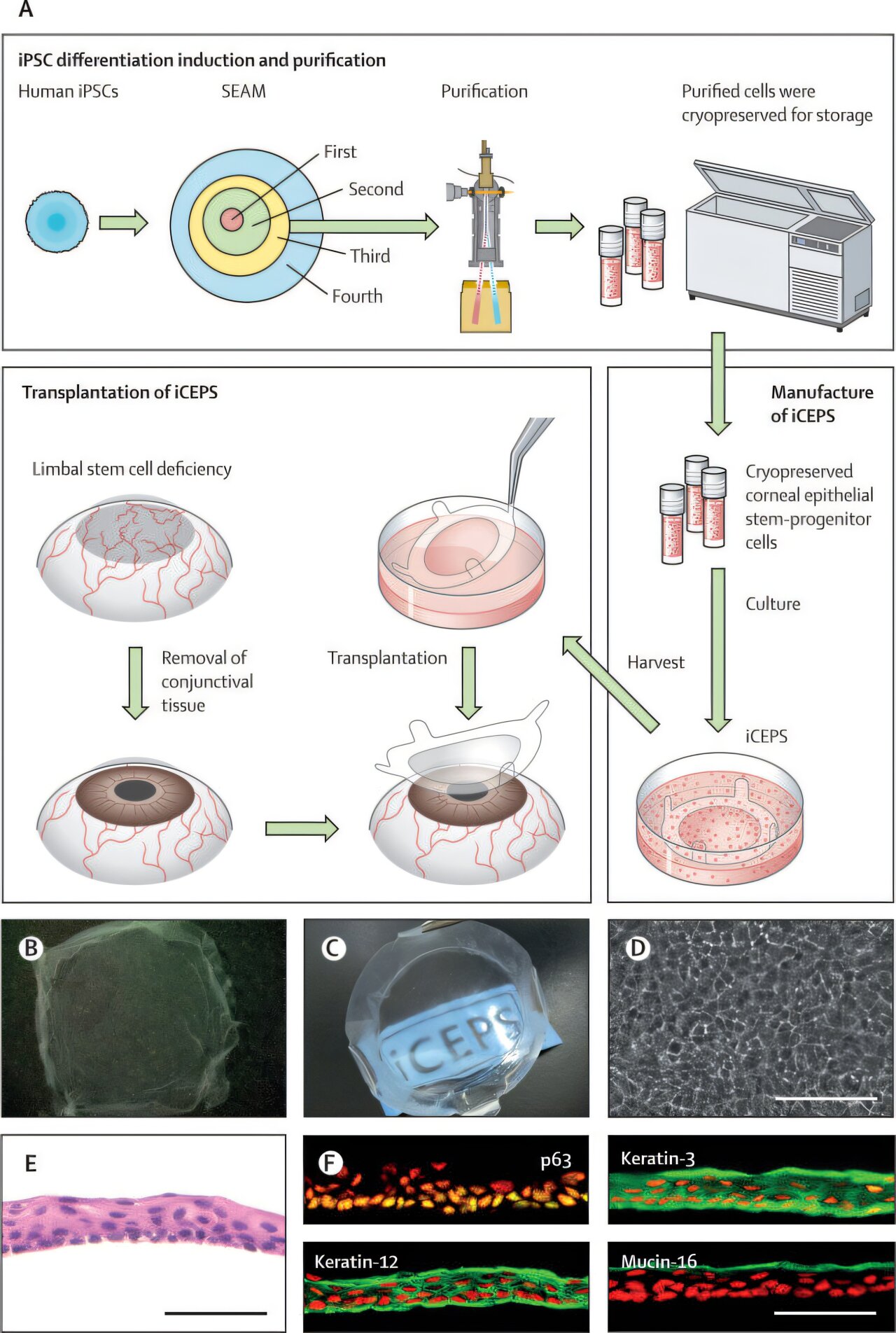 Featured image for Stem Cell Breakthrough Restores Vision in Medical First