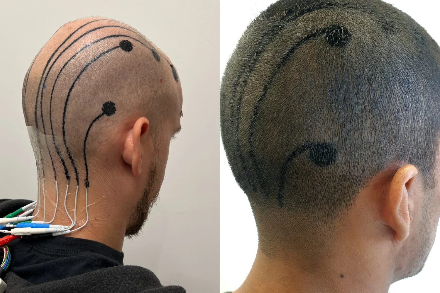 Featured image for Revolutionary E-Tattoos: The Future of Brainwave Monitoring