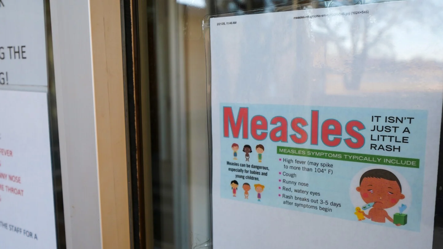 Wastewater signals measles early, helping public health act faster