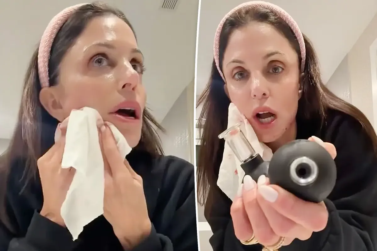 Bethenny Frankel Injures Her Face Testing Viral Beauty Tool