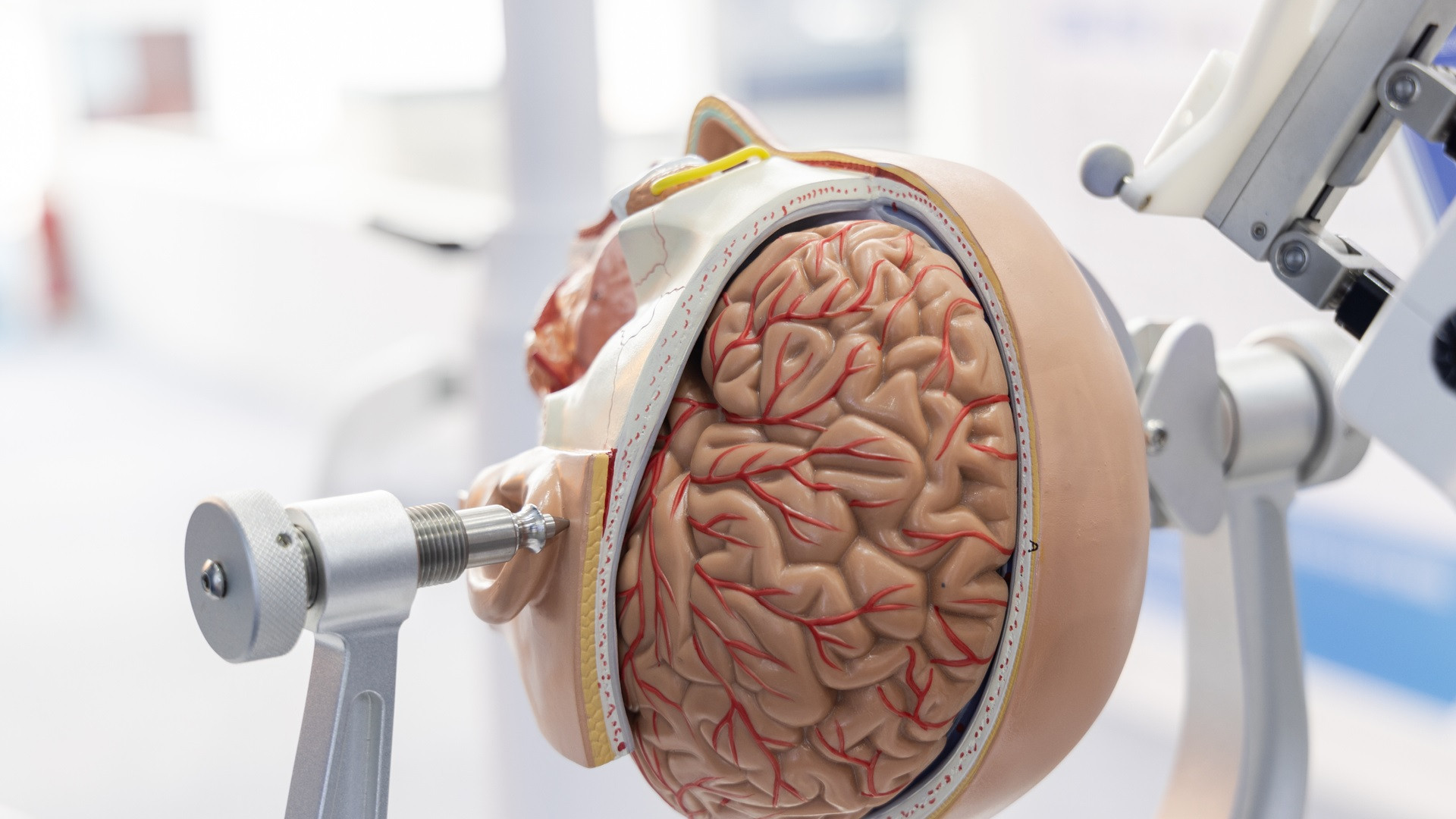 Featured image for Revolutionary Surgical Robot Safely Removes Brain Tumors in Children