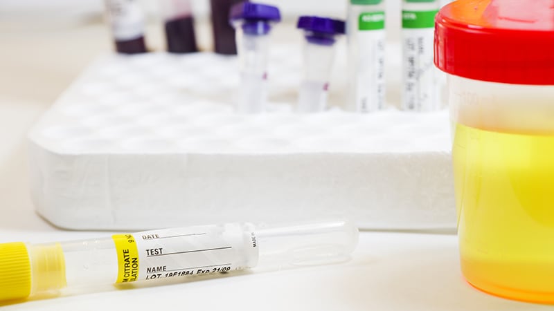 Featured image for "Revamped Guidelines for Diabetes Lab Tests Unveiled"