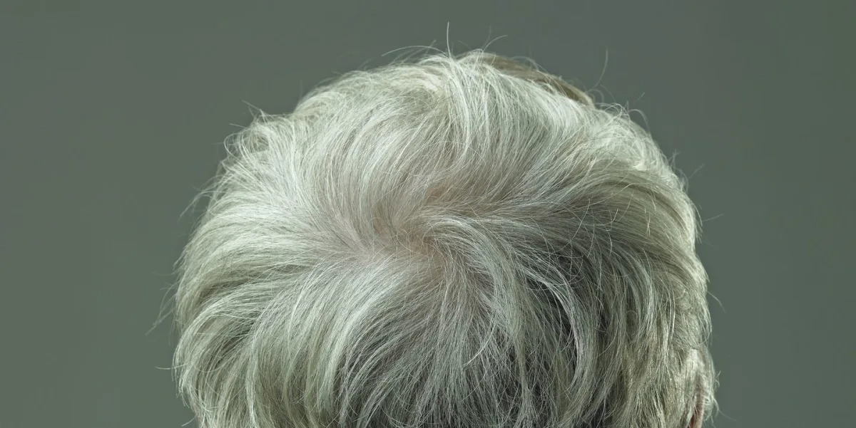 Featured image for Reversing Gray Hair: New Study Findings