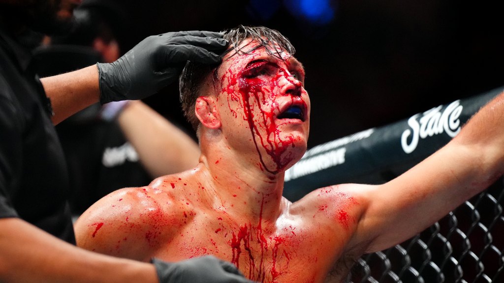 Featured image for "Drew Dober Suffers Deep Cut in UFC Denver TKO Loss"