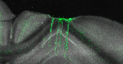 Hippocampus Emerges as a General-Purpose Statistical Learner Across Species