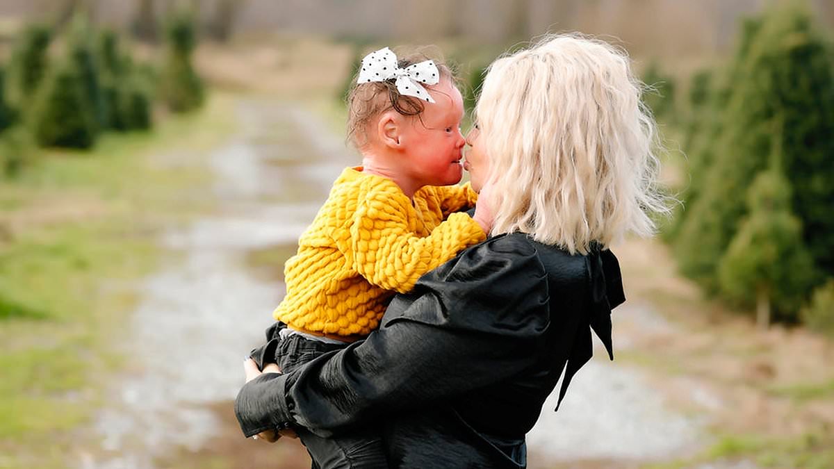 Rare Skin Disease Affects 8-Year-Old Girl, One of Few Worldwide