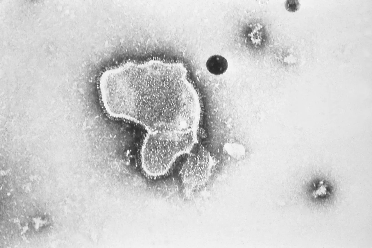 FDA Approves Groundbreaking RSV Vaccine for Infants and Pregnancy
