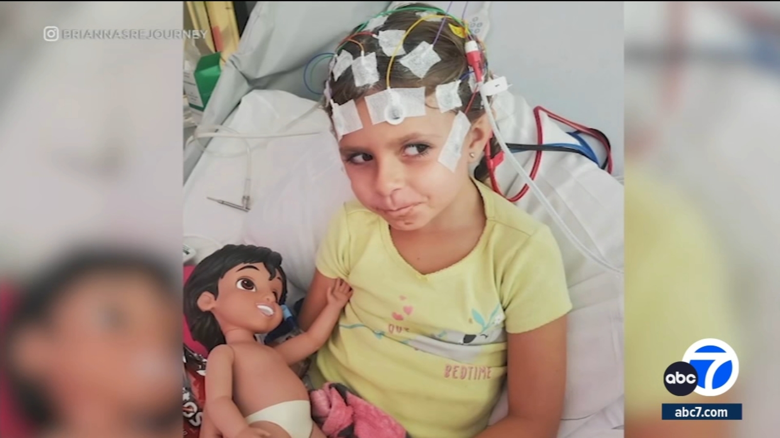 Featured image for Life-Changing Surgery: Doctors Disconnect Half of SoCal 6-Year-Old's Brain