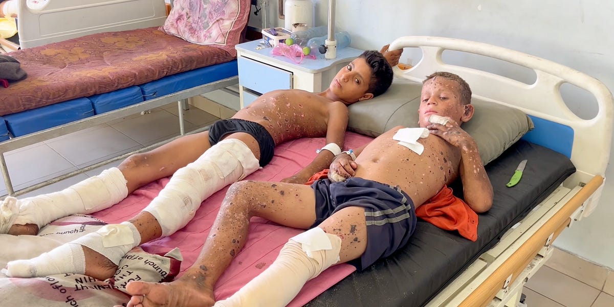 Featured image for Gaza's Minefield: UK Funds to Clear Unexploded Bombs Amid Ongoing Conflict