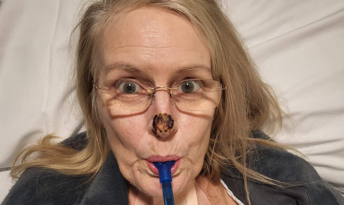 Featured image for Baking Soda Saves Woman from Flesh-Eating Bacteria