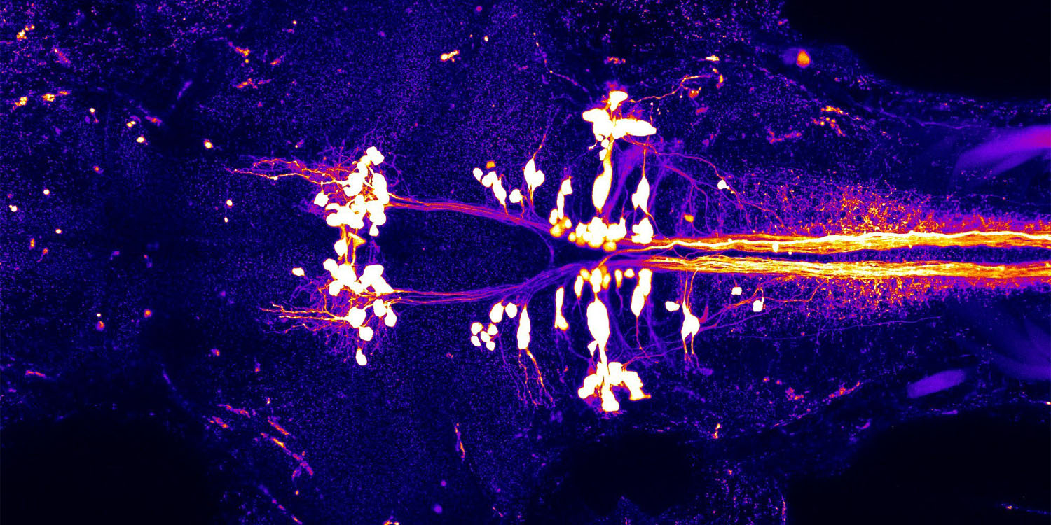 Featured image for "Harvard Scientists Uncover Remarkable Fact About Brain Development"
