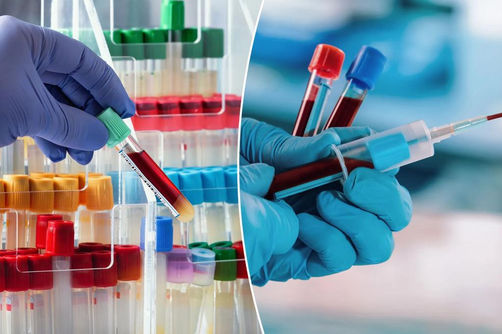 "Revolutionary Blood Test Identifies Schizophrenia Risk and Optimal Treatments"