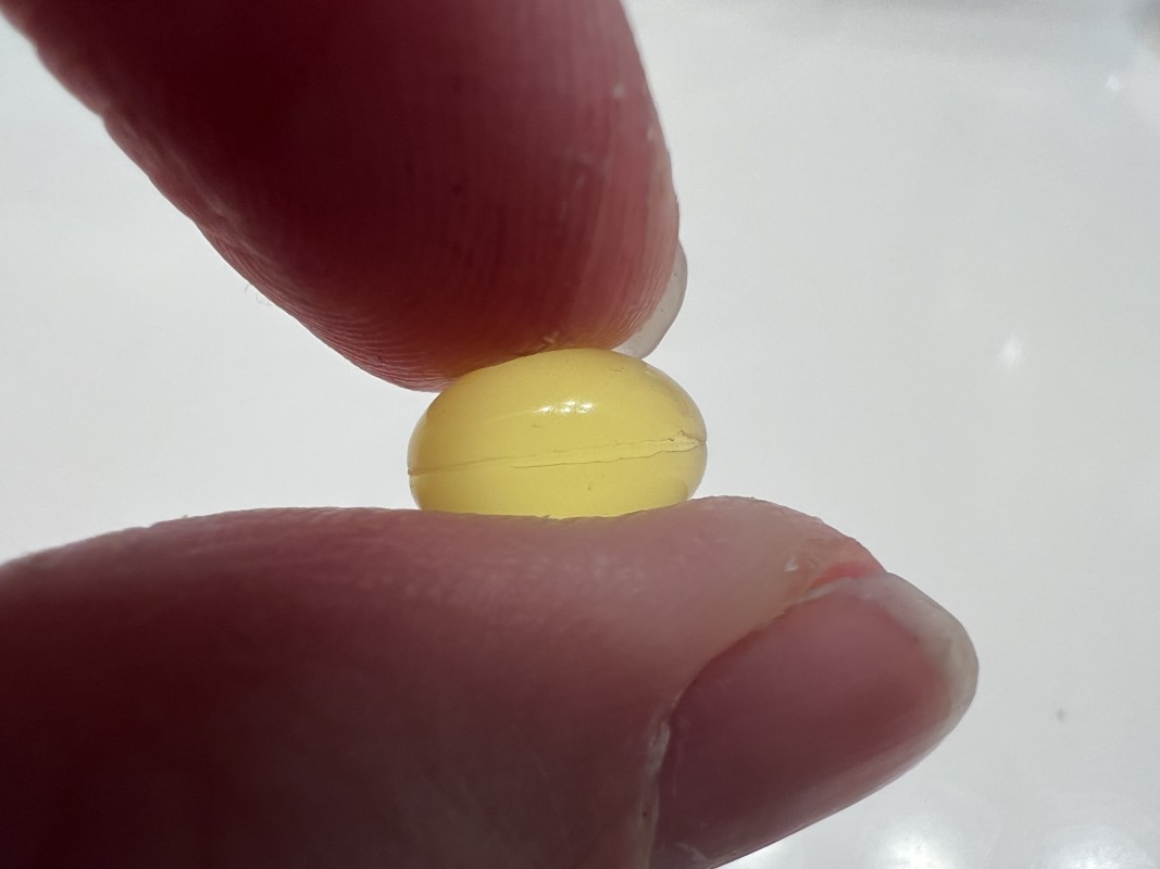 Featured image for "Fatal Vitamin D Overdose Raises Concerns Among Medical Experts"