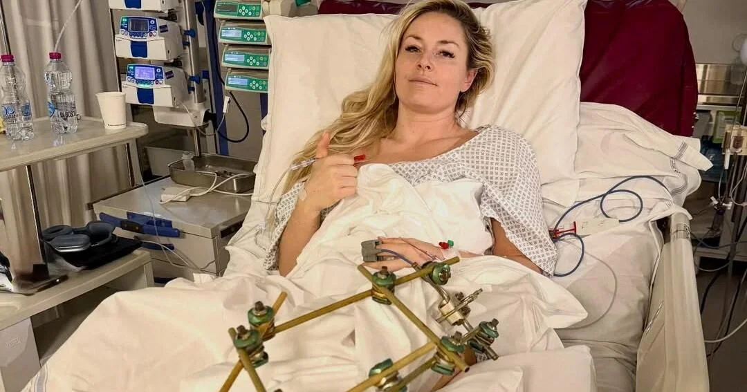 Vonn's leg spared by surgery after Olympic crash