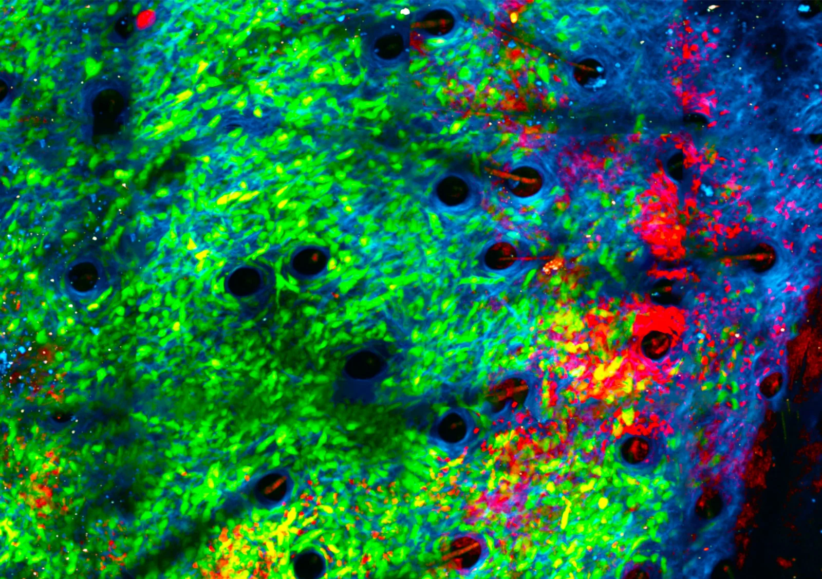 Harnessing Bacteria to Boost Cancer Treatment