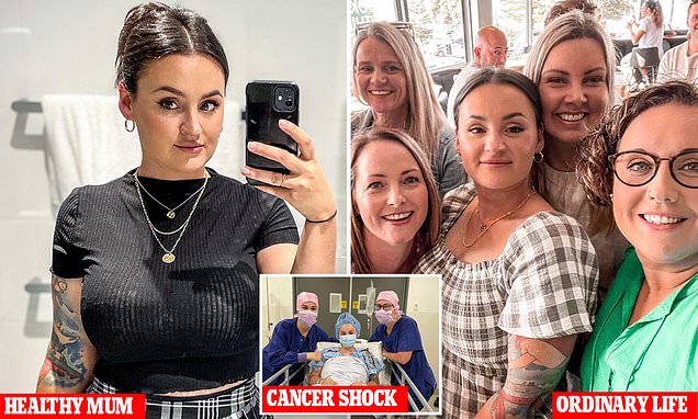 Early Signs of Bowel Cancer Can Be Misleading, Warns Nurse and Patient