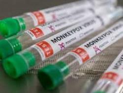 Jamaica reports two additional cases of Monkeypox.
