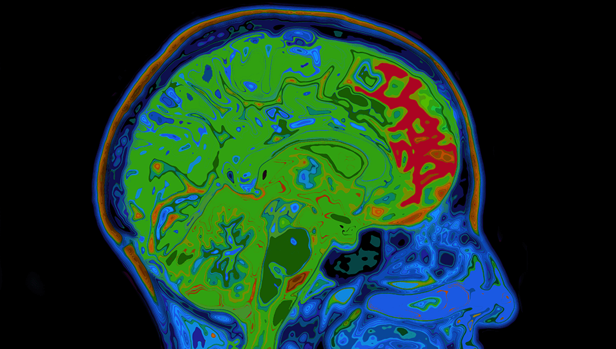 Featured image for Man Suffers From Rare "Groundhog Day" Syndrome