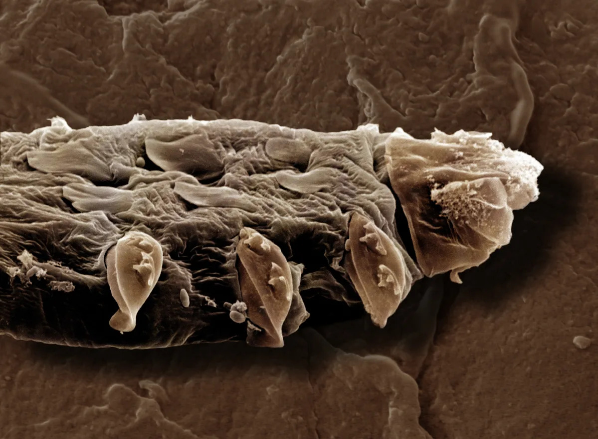 Featured image for Tiny Eyelash Bugs: Cause for Concern?