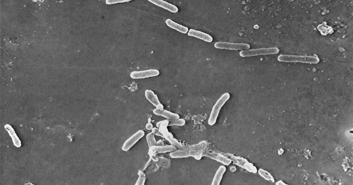 "Deadly Bacteria in Eye Drops Sparks Large-Scale Recall"