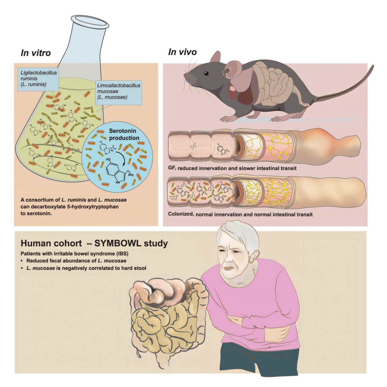 Featured image for Gut Microbes and Serotonin: New Hope for IBS and Pain Relief