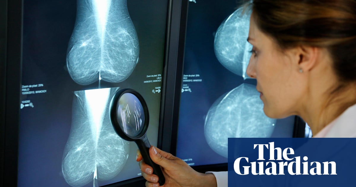 Featured image for "Social Vulnerability Linked to Missed Mammograms in US Women, CDC Study Reveals"