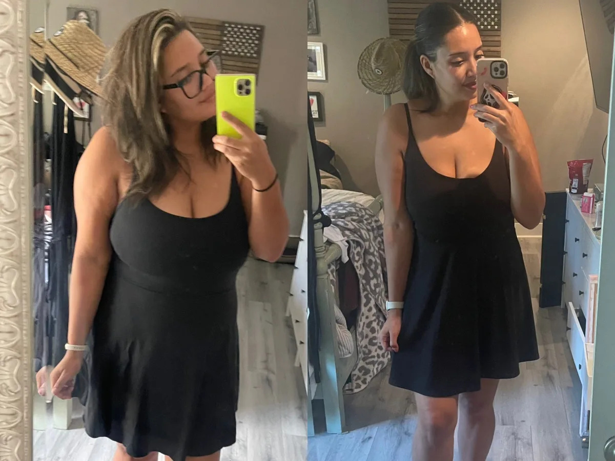 Semaglutide: A Game-Changer for Weight Loss and PCOS?