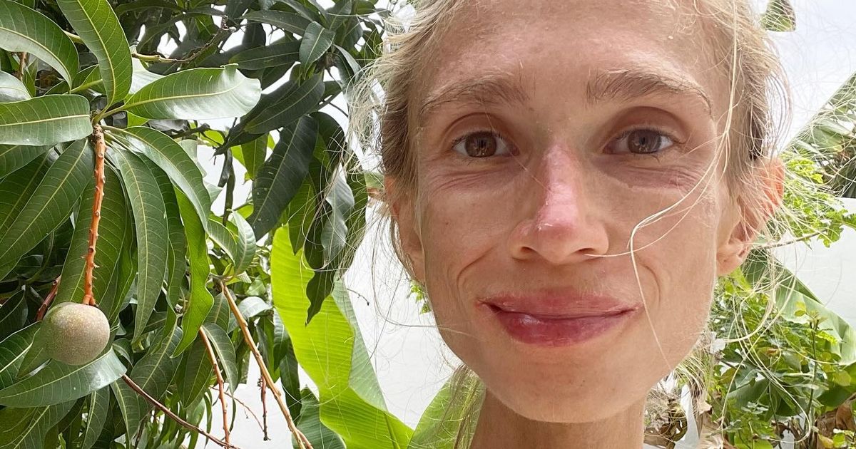 Featured image for Woman Dies of Starvation After Extreme Fruit-Only Diet