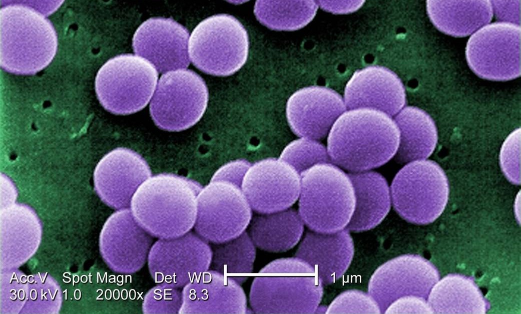 Featured image for "Unveiling the Hidden Weapon: Dark Matter of Bacteria Yields Powerful Antibiotic Against Superbugs"