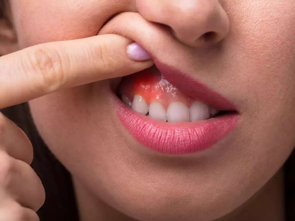 "8 Essential Tips for Tightening Your Gums at Home"