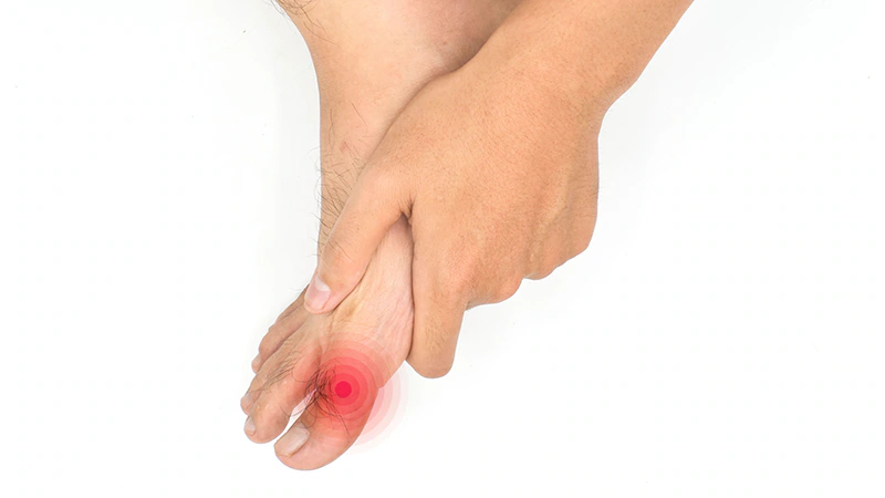 Featured image for Diabetes Drug Shows Promise in Reducing Gout Medication Use
