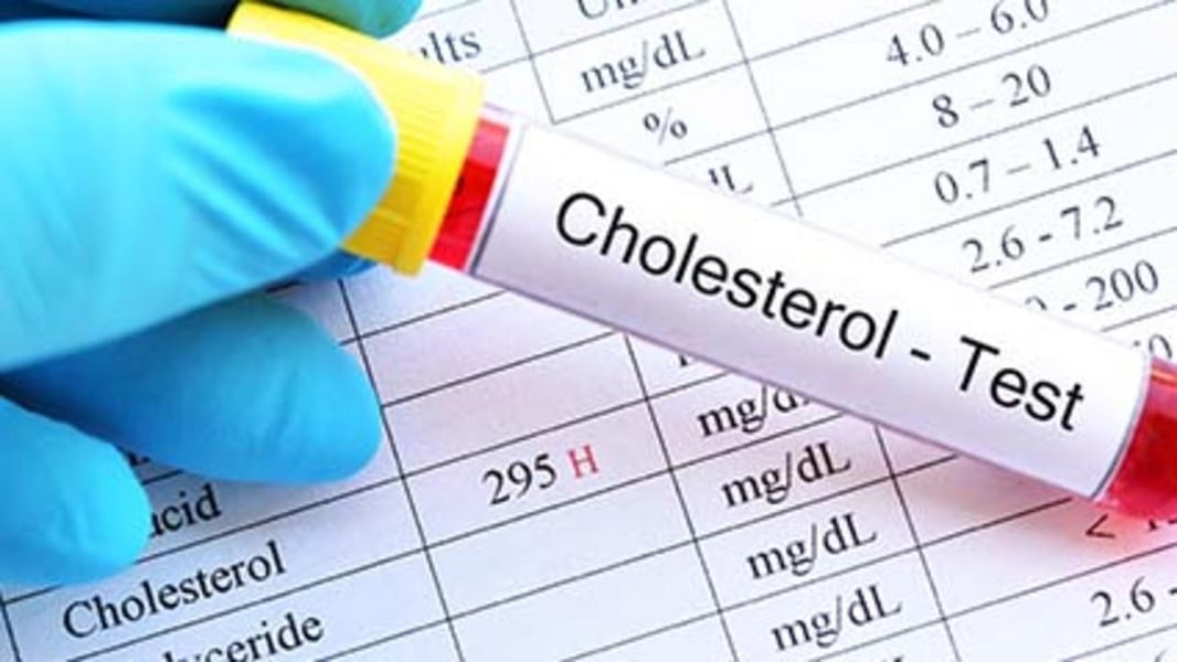 Featured image for The Surprising Link Between HDL Cholesterol and Dementia Risk